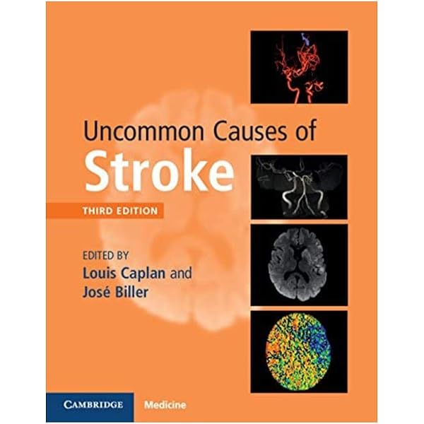 Caplan&#39;s Stroke: A Clinical Approach [ハードカバー] Caplan， Louis R. Caplan's stroke : a clinical approach | WorldCat.org